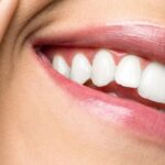 cosmetically cleaned teeth