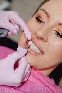 choosing a porcelain veneer