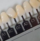 selection of veneers and lumineers