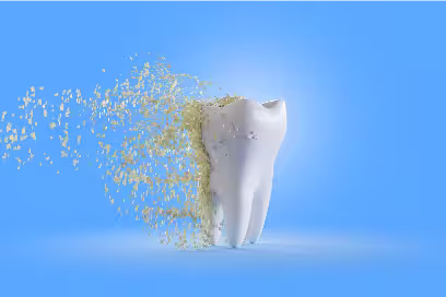 restorative dentistry homepage graphic of plaque falling off a tooth